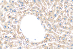 LCAT Antibody in Immunohistochemistry (Paraffin) (IHC (P))
