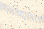 LCAT Antibody in Immunohistochemistry (Paraffin) (IHC (P))