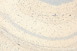 LCAT Antibody in Immunohistochemistry (Paraffin) (IHC (P))