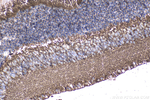 ARMS2 Antibody in Immunohistochemistry (Paraffin) (IHC (P))