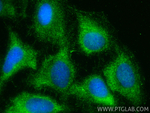 MAST2 Antibody in Immunocytochemistry (ICC/IF)