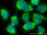 MAST2 Antibody in Immunocytochemistry (ICC/IF)