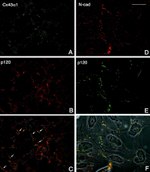 N-cadherin Antibody in Immunocytochemistry (ICC/IF)