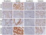 N-cadherin Antibody in Immunohistochemistry (IHC)