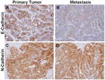 N-cadherin Antibody in Immunohistochemistry (IHC)