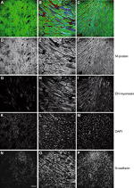 N-cadherin Antibody in Immunohistochemistry (IHC)
