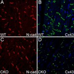 N-cadherin Antibody in Immunohistochemistry (IHC)