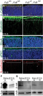 N-cadherin Antibody in Immunohistochemistry (IHC)