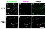N-cadherin Antibody in Immunohistochemistry (IHC)