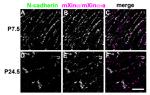 N-cadherin Antibody in Immunohistochemistry (IHC)