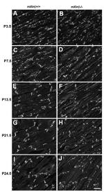 N-cadherin Antibody in Immunohistochemistry (IHC)