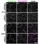 N-cadherin Antibody in Immunohistochemistry (IHC)
