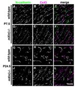 N-cadherin Antibody in Immunohistochemistry (IHC)
