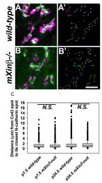 N-cadherin Antibody in Immunohistochemistry (IHC)