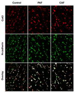 N-cadherin Antibody in Immunohistochemistry (IHC)