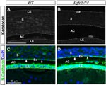 N-cadherin Antibody in Immunohistochemistry (IHC)