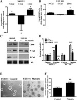 N-cadherin Antibody in Western Blot (WB)
