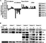 N-cadherin Antibody in Western Blot (WB)