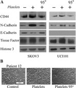 N-cadherin Antibody in Western Blot (WB)