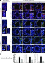 N-cadherin Antibody in Immunohistochemistry (IHC)