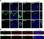 N-cadherin Antibody in Immunohistochemistry (IHC)