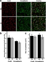 N-cadherin Antibody in Immunocytochemistry (ICC/IF)