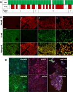 N-cadherin Antibody in Immunohistochemistry (IHC)