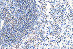 SLAMF6 Antibody in Immunohistochemistry (Paraffin) (IHC (P))