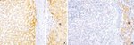 E-cadherin Antibody in Immunohistochemistry (Paraffin) (IHC (P))