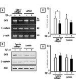 E-cadherin Antibody in Western Blot (WB)