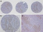 E-cadherin Antibody in Immunohistochemistry (Paraffin) (IHC (P))
