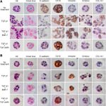 E-cadherin Antibody in Immunohistochemistry (IHC)