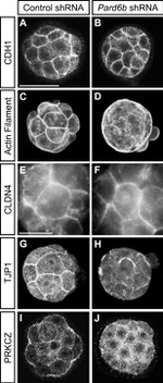 E-cadherin Antibody in Immunocytochemistry (ICC/IF)