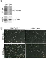 E-cadherin Antibody in Western Blot (WB)