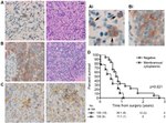 E-cadherin Antibody in Immunohistochemistry (IHC)
