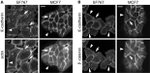 E-cadherin Antibody in Immunohistochemistry (IHC)