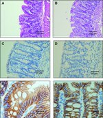 E-cadherin Antibody in Immunohistochemistry (Paraffin) (IHC (P))