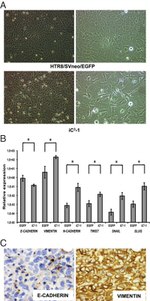E-cadherin Antibody in Immunohistochemistry (IHC)