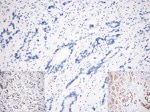 E-cadherin Antibody in Immunohistochemistry (IHC)