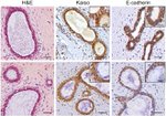 E-cadherin Antibody in Immunohistochemistry (IHC)