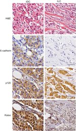 E-cadherin Antibody in Immunohistochemistry (IHC)