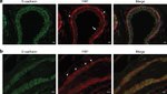 E-cadherin Antibody in Immunohistochemistry (Paraffin) (IHC (P))