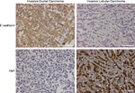 E-cadherin Antibody in Immunohistochemistry (Paraffin) (IHC (P))