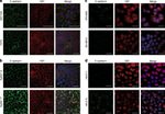 E-cadherin Antibody in Immunohistochemistry (Paraffin) (IHC (P))