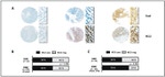 E-cadherin Antibody in Immunohistochemistry (IHC)