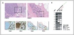 E-cadherin Antibody in Immunohistochemistry (IHC)