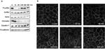 E-cadherin Antibody in Western Blot (WB)