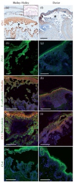 E-cadherin Antibody in Immunohistochemistry (IHC)