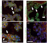 E-cadherin Antibody in Immunohistochemistry (IHC)