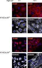 E-cadherin Antibody in Immunocytochemistry (ICC/IF)